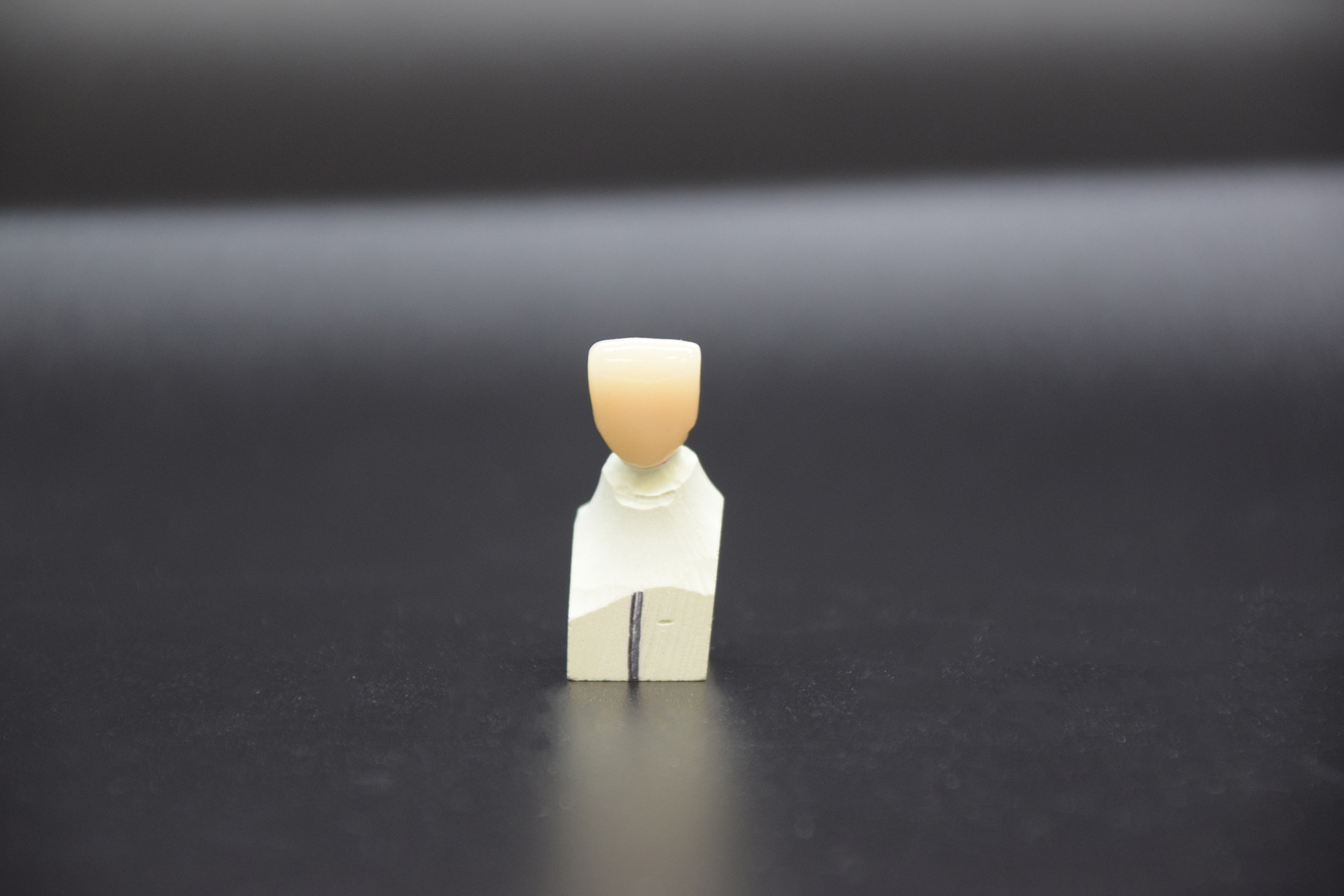 Single zirconia anterior crown displayed on a dental model