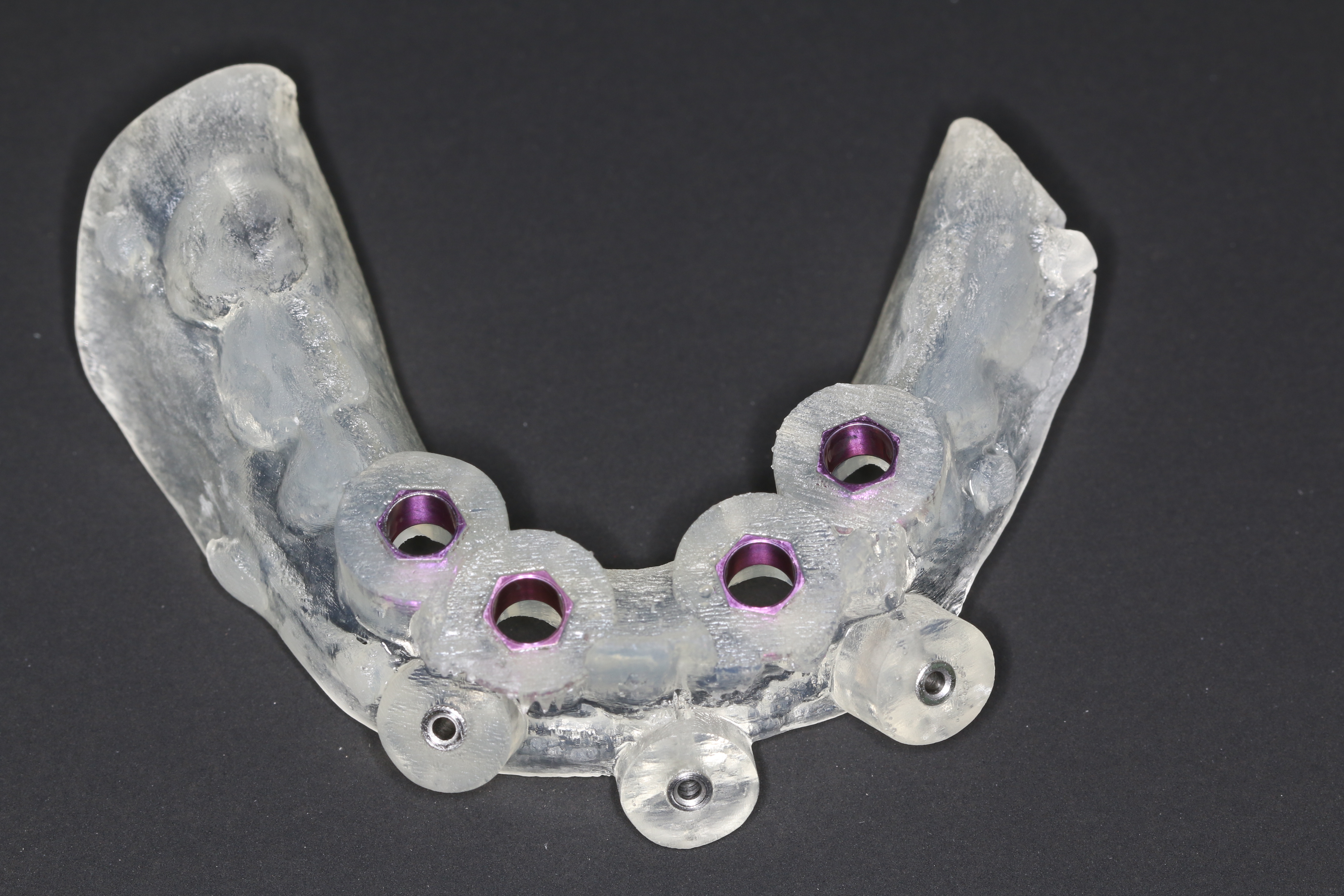 Dental surgical guide used to position implants during guided surgery